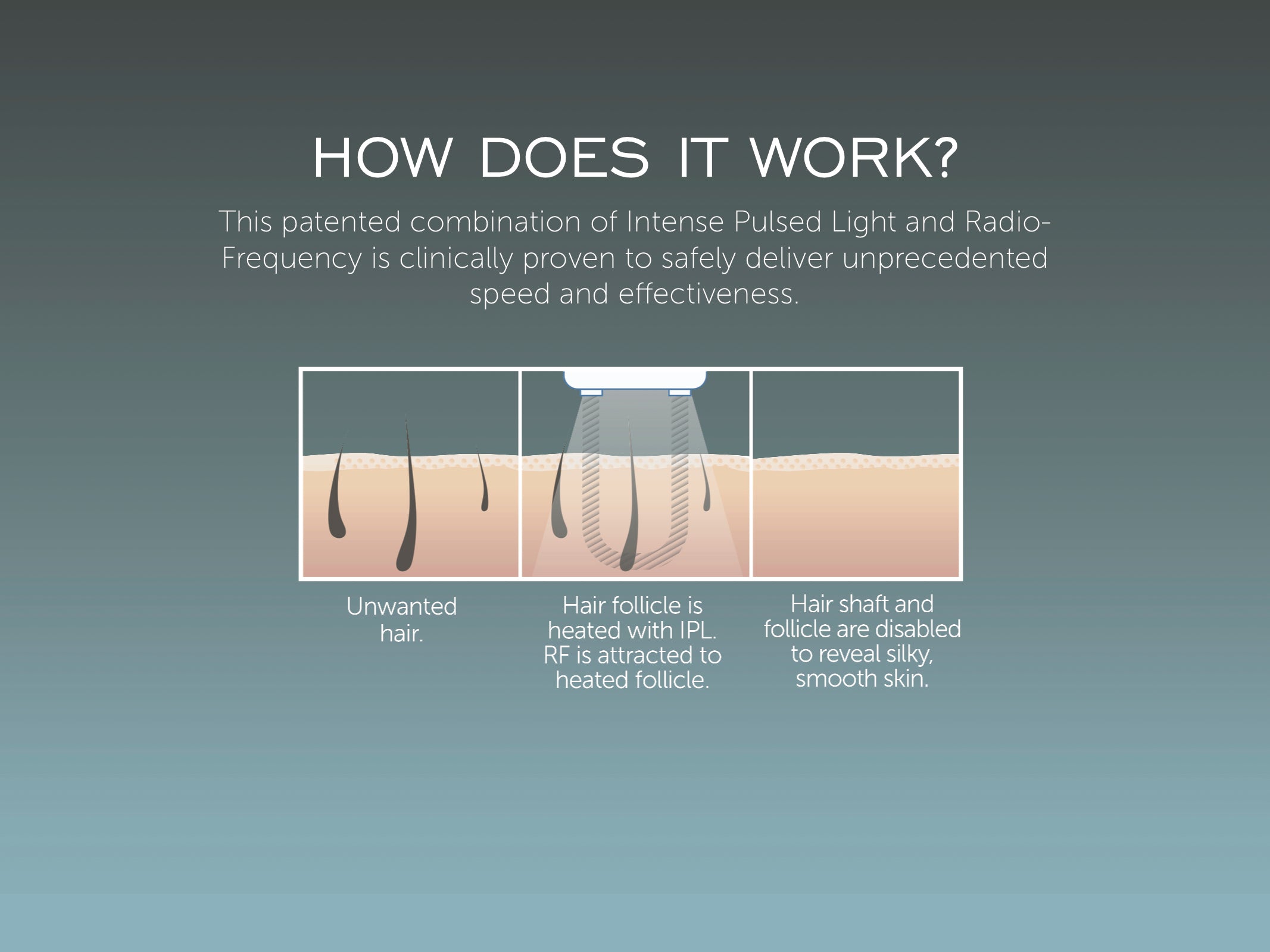 Ora iluminage touch permanent hair reduction system Clearance